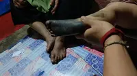Zumrotun (35), warga Desa Tempel Lemahbang, Kecamatan Jepon, Kabupaten Blora, Jawa Tengah, memperlihatkan kaki anaknya yang kotor menginjak debu pabrik briket. (Liputan6.com/ Ahmad Adirin)