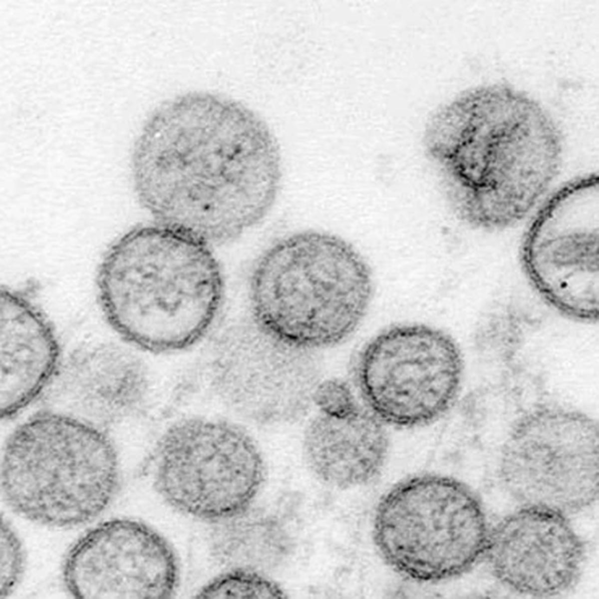 Ilustrasi virus hanta.