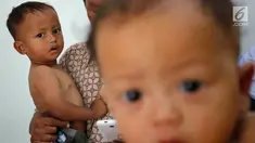 Anak balita ketika akan ditimbang, diukur tinggi badan di Puskesmas, Kaduhejo, Pandeglang (14/9). Tidak hanya penduduk Asmat di Papua, penduduk Kaduhejo, Pandeglang, sekitar 80 km dari Ibukota Jakarta, juga terindikasi masalah malnutrisi. (Foto:Istimewa)
