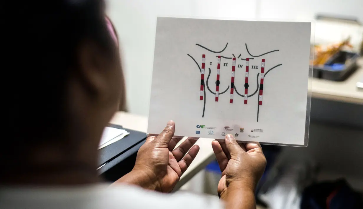 Pasien melihat sebuah diagram pemeriksaan payudara yang akan dilakukan petugas medis tunanetra di sebuah rumah sakit di Cali, Kolombia (14/11). (AFP/Luis Robayo)
