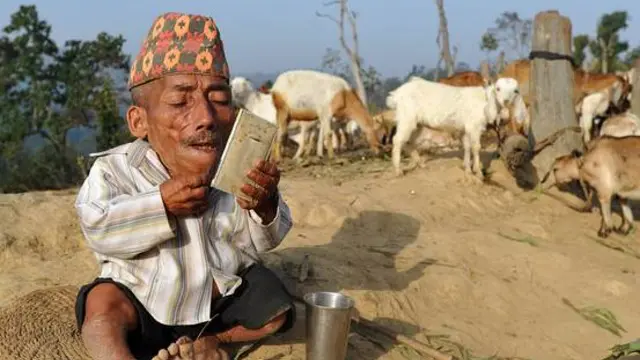 Penyakit Ini Merenggut Nyawa Pria Terpendek di Dunia