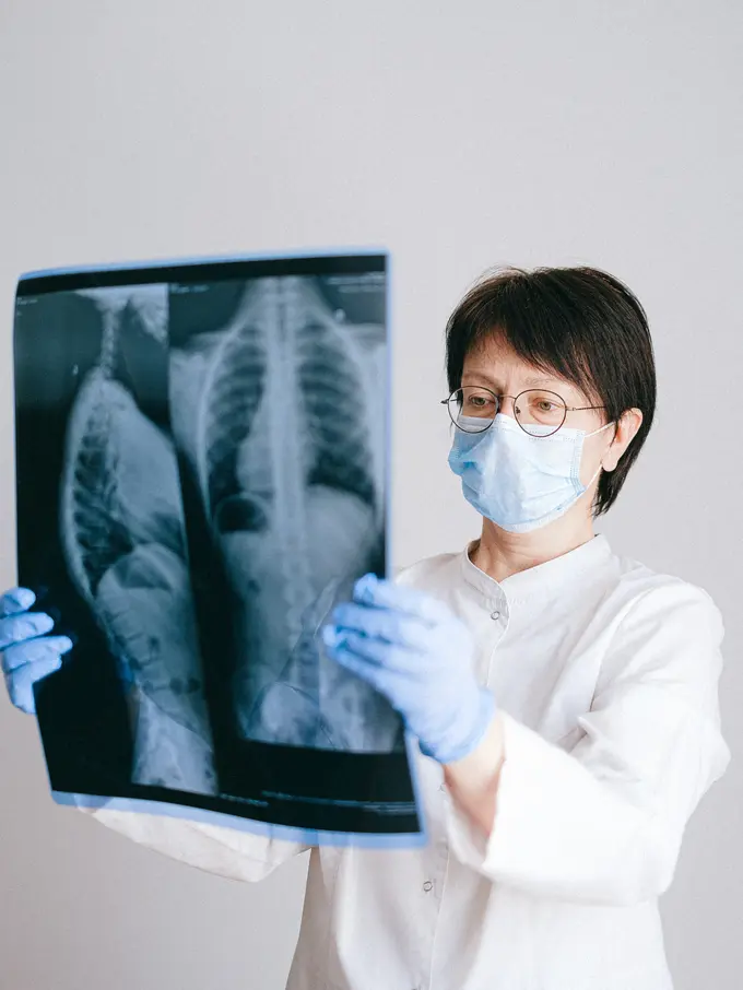 Ilustrasi Tuberkulosis