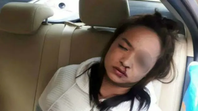 Karena kecelakaan lalu lintas, seorang wanita penumpang taksi tersentak ke depan dengan pensil masih di tangannya.
