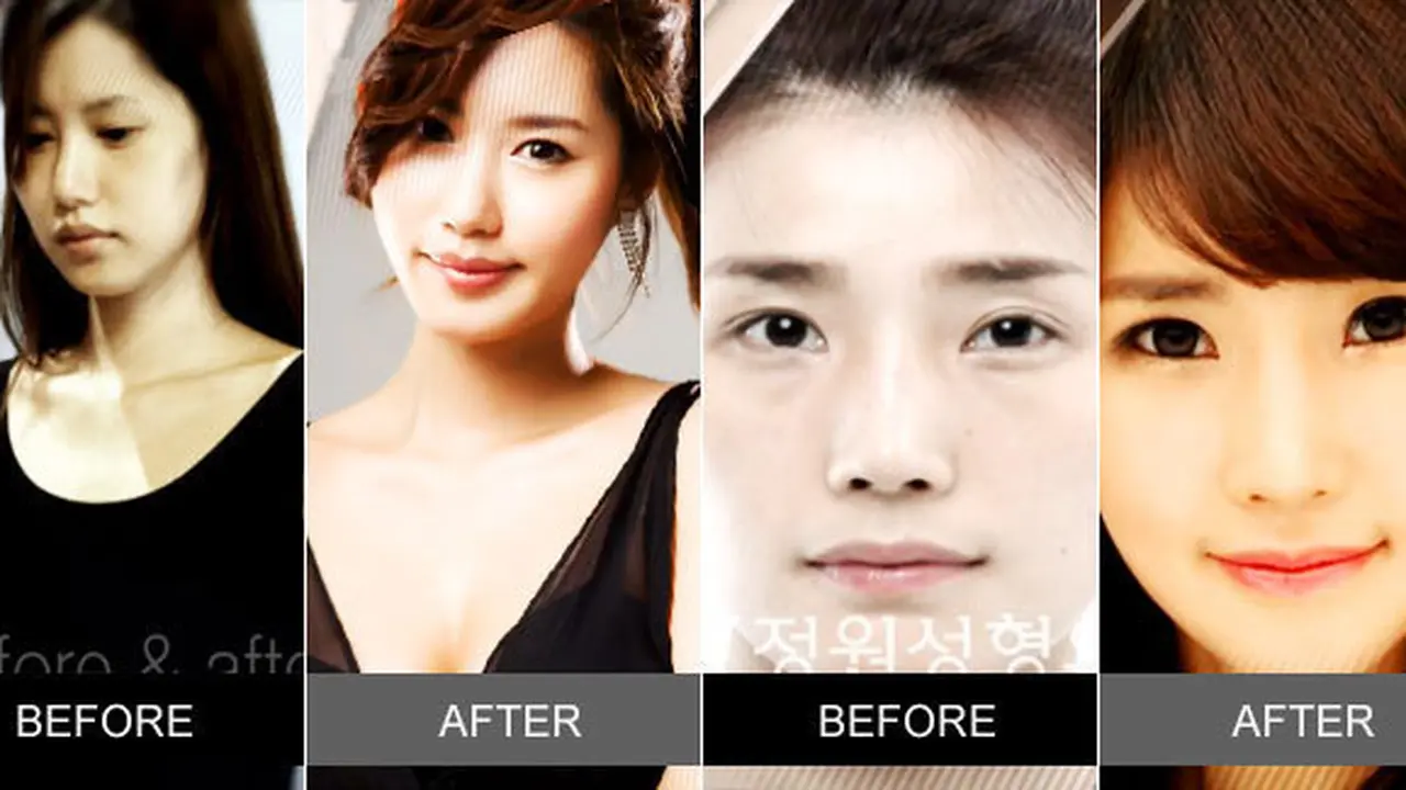 (c) JWplasticsurgeryKOR/youtube.com