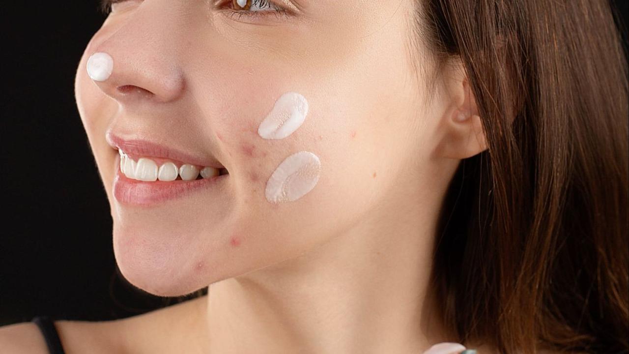 Oleskan Obat Jerawat
