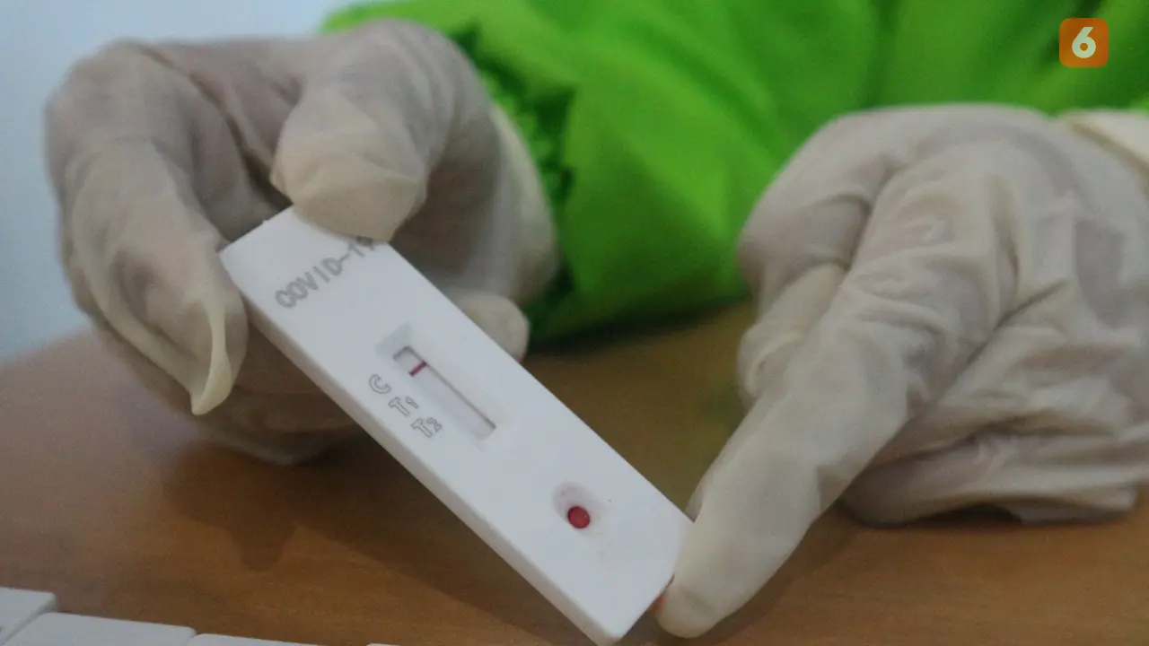Kit rapid test
