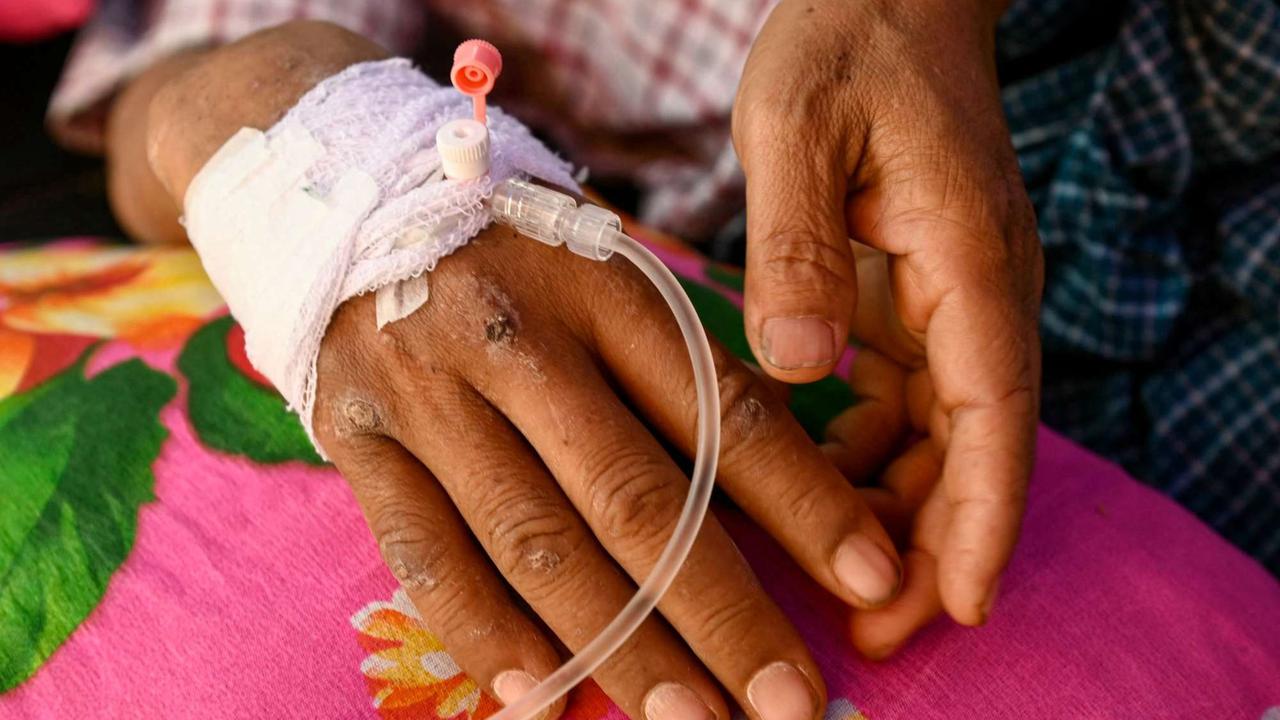Pria Myanmar diselamatkan hidup-hidup setelah 5 hari tertimbun reruntuhan hotel akibat gempa