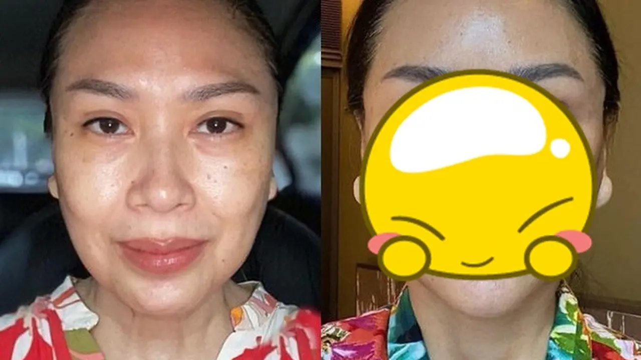 6 Potret Transformasi Titi DJ Usai Operasi Anti Aging, Makin Awet Muda