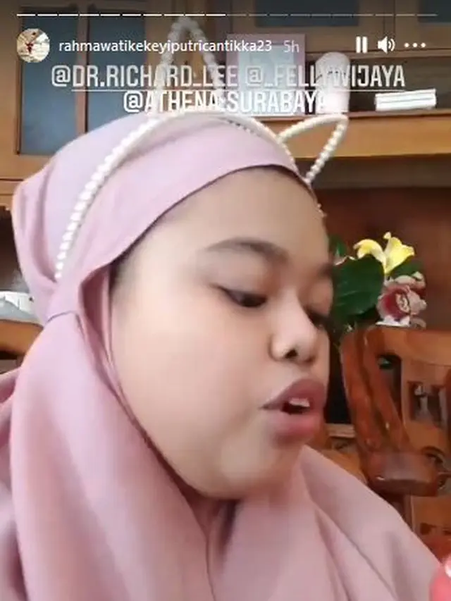 6 Potret Terbaru Kekeyi Setelah Filler Hidung, Tampil Beda