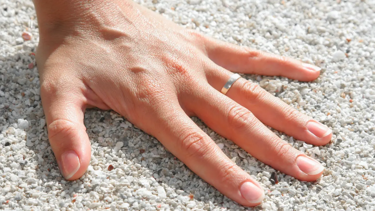 Penyakit Ginjal, Scleroderma, dan Konsumsi Obat
