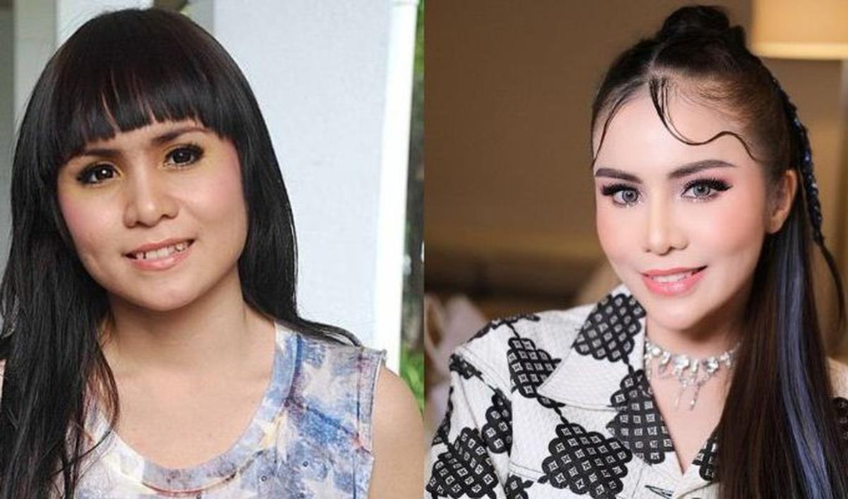 Momo, mantan personel Geisha, juga memiliki gigi gingsul sebelumnya.&nbsp;