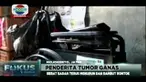 Kanker tulang yang menyerang tubuh Siti Qomariah (14) membuat lutut kaki kanannya membengkak sebesar bola sepak. Gadis kelas 2 SMP ini tidak bisa sekolah selama 5 bulan lalu.