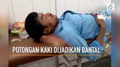 Viral rekaman seorang pasien di India menggunakan potongan kaki sebagai bantal.