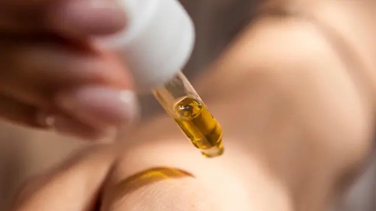 Saran Dokter Tompi Jika Kulit Mati Akibat Pakai Skincare Berlebihan