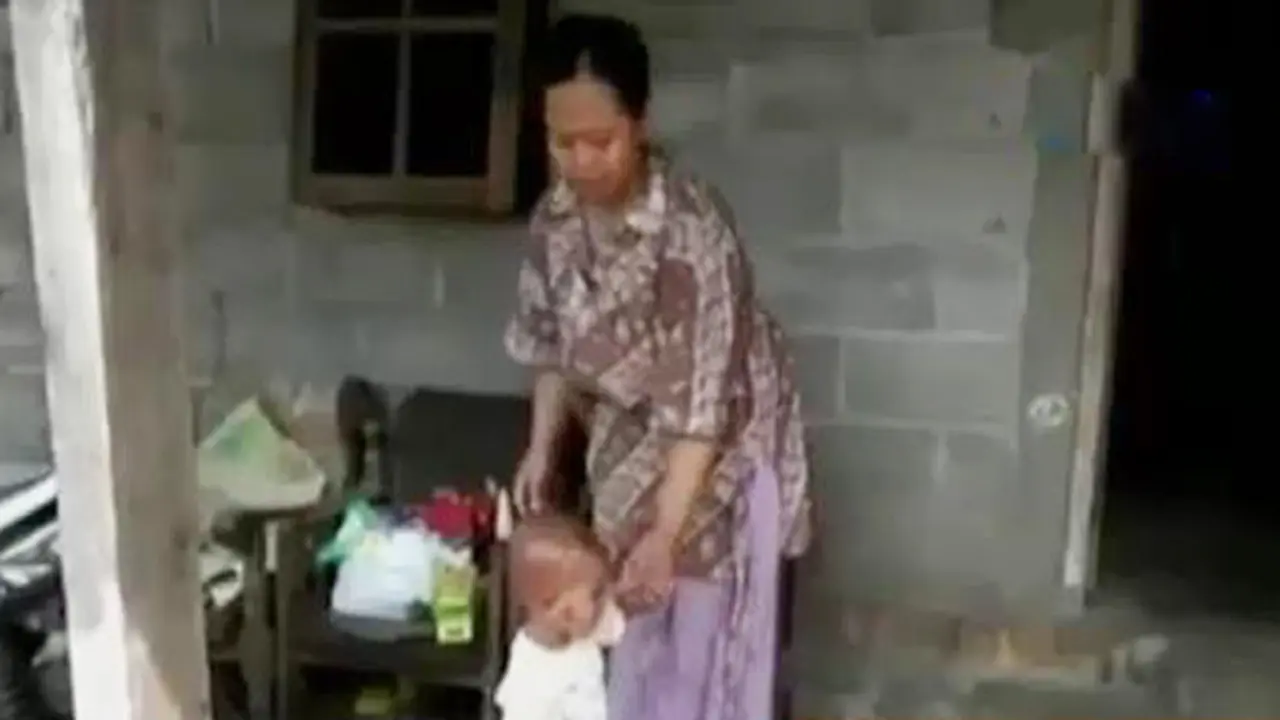 Bocah Bersisik