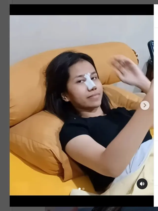 Mayang adik Vanessa Angel disebut habis operasi plastik pada bagian hidung (Foto IG dodysoedrajat_1)