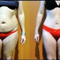 Punya masalah berat badan, tapi kesulitan untuk menurunkannya? Jangan khawatir, cobalah resep yang nggak kalah ampuh dari diet ini.
