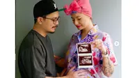 Kehamilan Claudia Adinda Jadi Kado Ultah Terindah Derby Romero