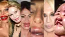 Operasi kecantikan malah membuat enam wanita ini semakin mengerikan (Istimewa)