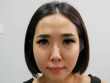 Gisella Anastasia saat perawatan di AA Clinic, Kuningan, Jakarta