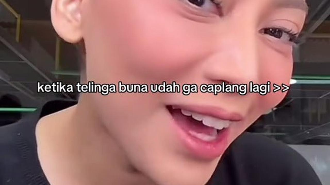 Rachel Vennya Perlihatkan Kuping Baru, Akui Merasa Bahagia Tak Caplang Lagi: Mungkin Pas Lagi 'di Pabrik' Lupa Dijahit