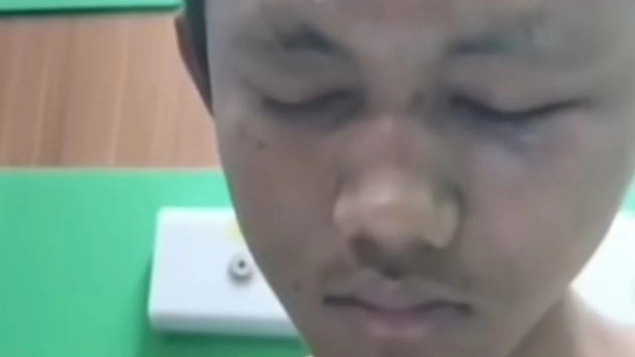Kasus Pengeroyokan Mahasiswa Undip Naik Penyidikan, Enam Saksi Diperiksa Polisi