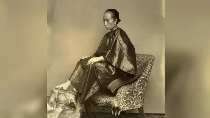 Foot binding adalah kebiasaan menerapkan pengikatan ketat pada kaki gadis-gadis untuk memodifikasi bentuk dan ukuran kaki mereka (Wikipedia/Public Domain)