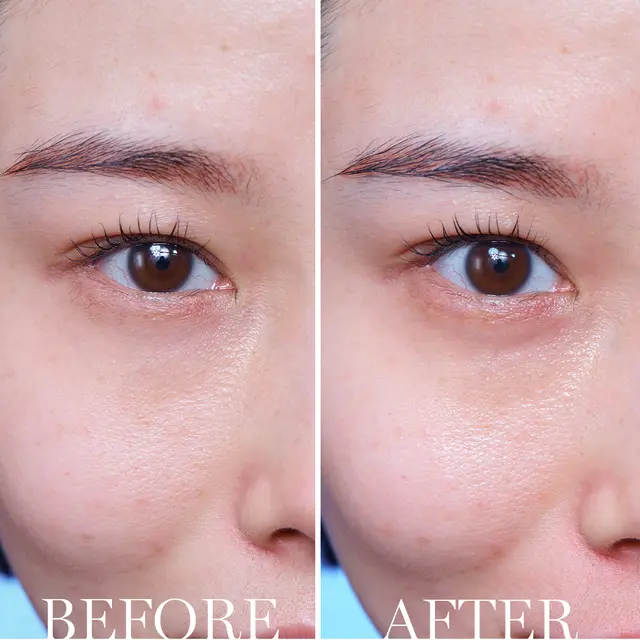 Lancôme Advanced Génifique Yeux