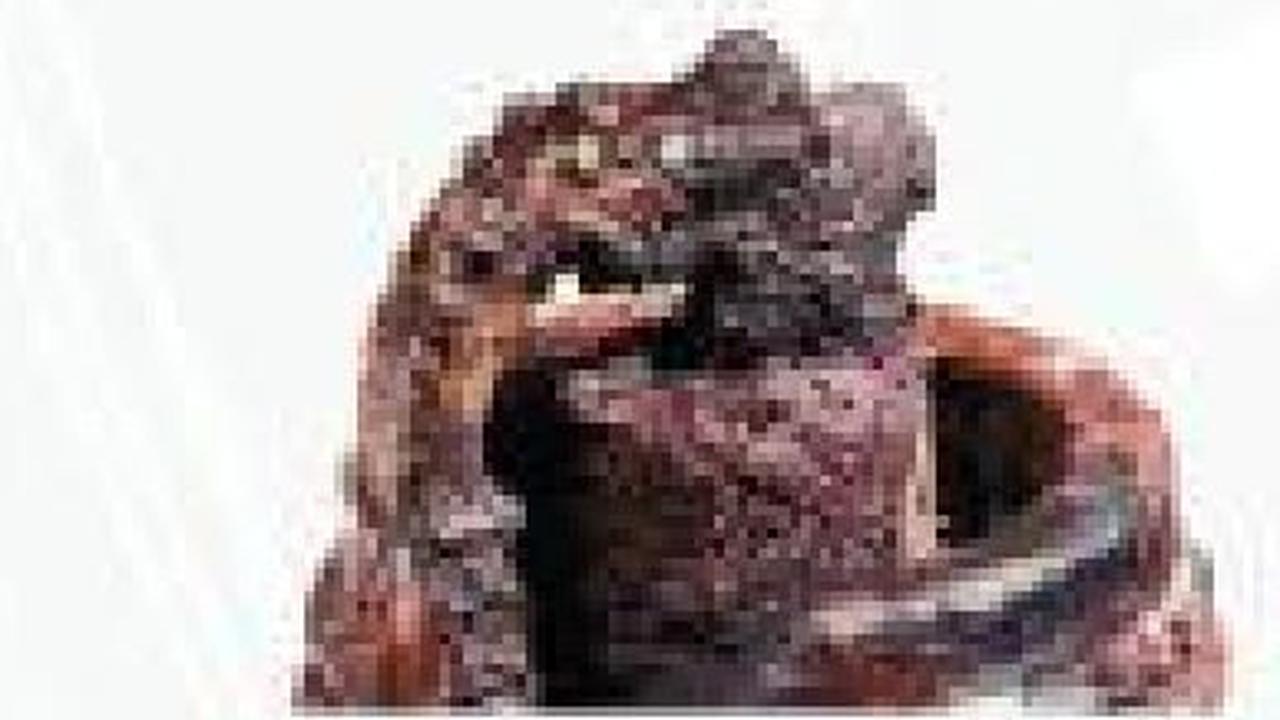 7. Busi Kepala Mengalami Kerusakan Mekanis
