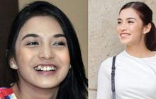 Transformasi 6 Artis Setelah Hilangkan Gigi Gingsul, Ini Potret Sebelum dan Sesudahnya