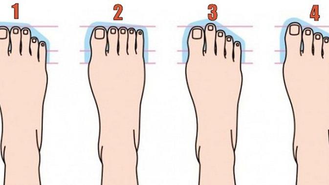Menebak Kepribadian Lewat 4 Macam Bentuk Jari Kaki Fimela Fimela Com