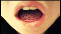 Trypophobia, Takut dengan Lubang Sedang Ramai di Sosmed