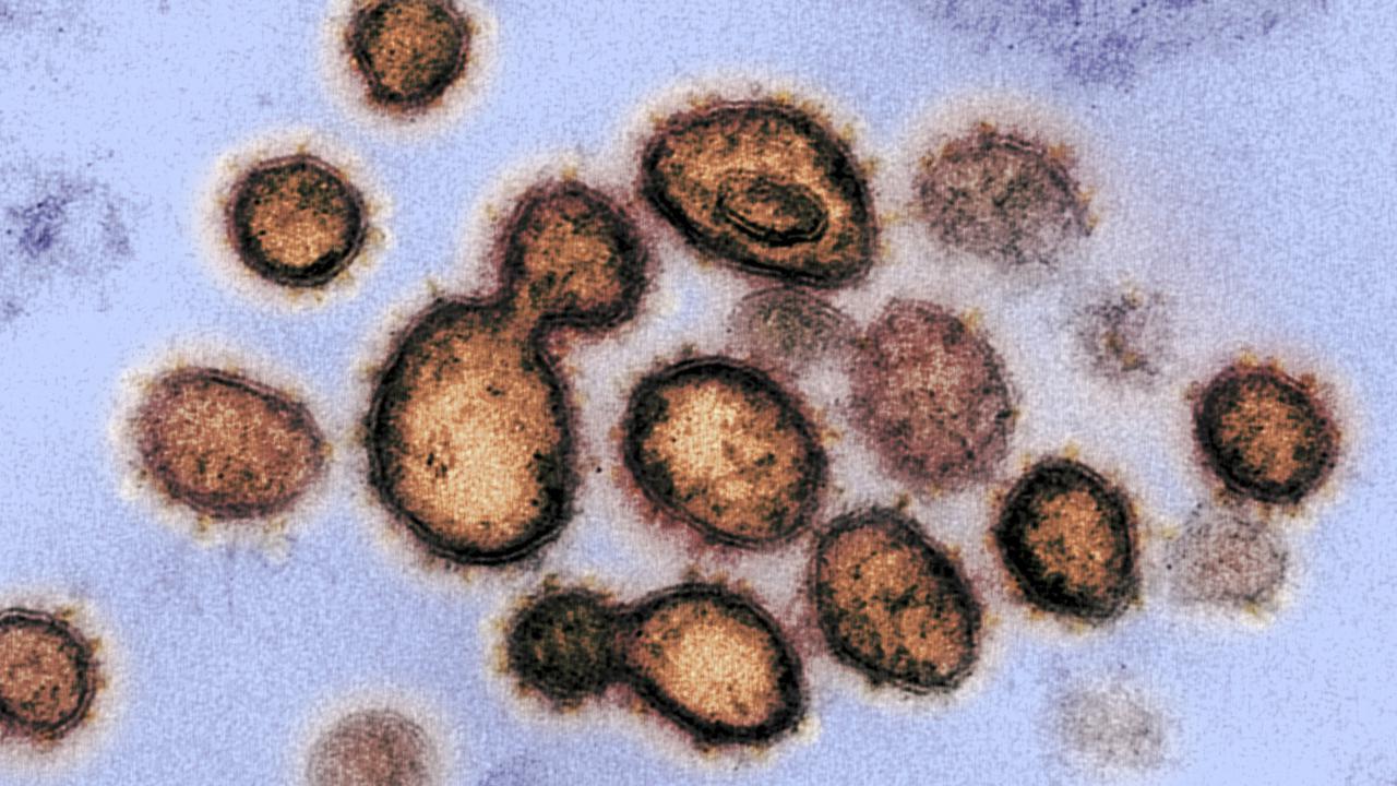 Ilustrasi gambar SARS-CoV-2, virus yang menyebabkan Corona COVID-19, diisolasi dari seorang pasien di AS. Diperoleh 27 Februari 2020 milik National Institutes of Health yang diambil dengan mikroskop elektron transmisi.(AFP/National Institutes Of Health)