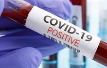 Sejarah 2 Maret: Kasus Pertama Virus Covid-19 di Indonesia