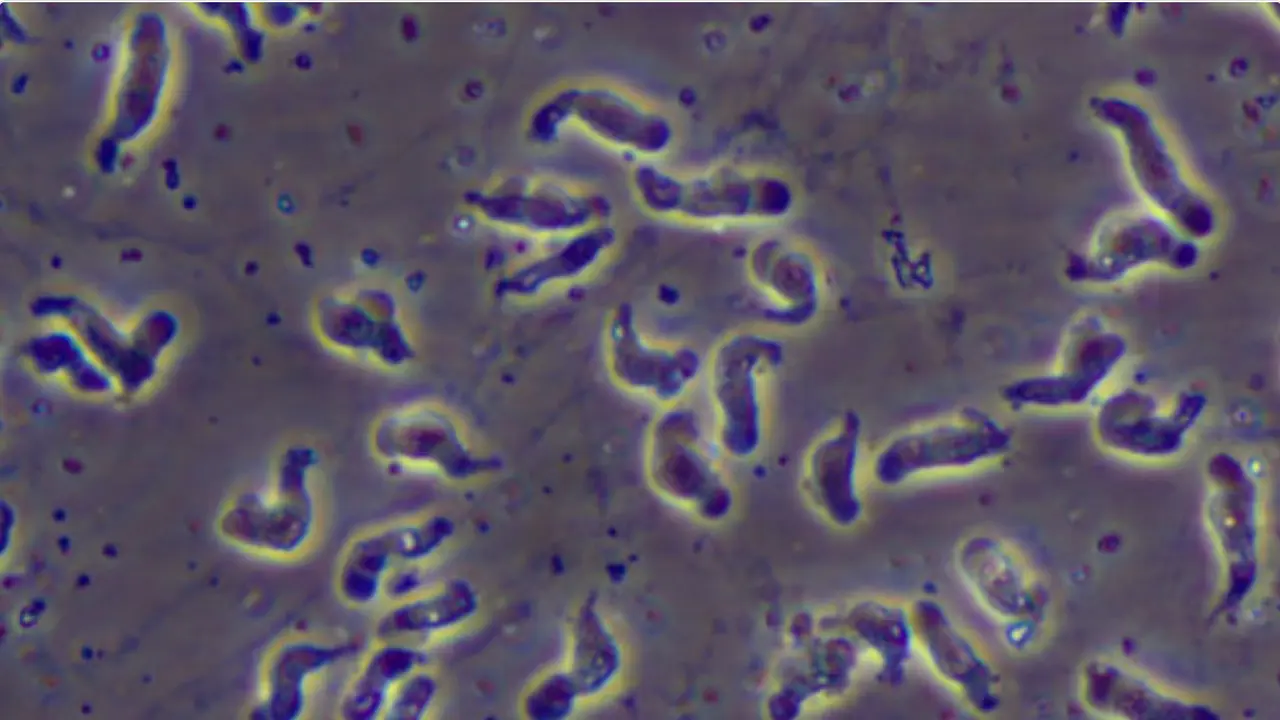 Foto Naegleria fowleri, amoeba pemakan otak.