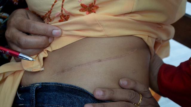 Kisah Wanita Di Malang Tagih Uang Donor Ginjal