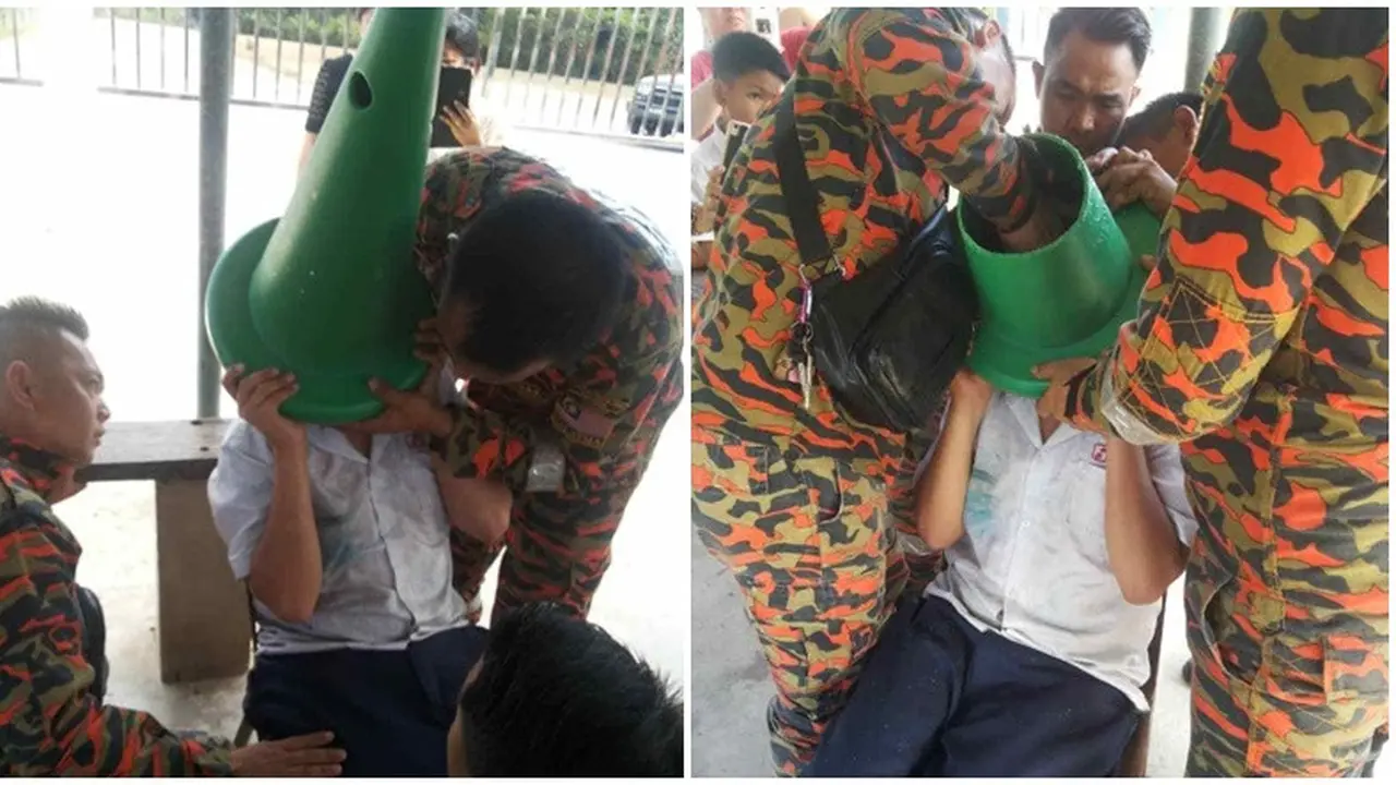 Kepala Bocah Ini Terjebak Kerucut Lalu Lintas, Butuh 5 Petugas Untuk Melepasnya