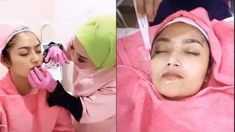 4 Perawatan Wajah yang Bikin Siti Badriah Makin Cantik, Terbaru Filler Bibir