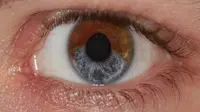 Ubah warna mata menjadi biru secara alami dengan laser mata (sumber. techly.com.au)