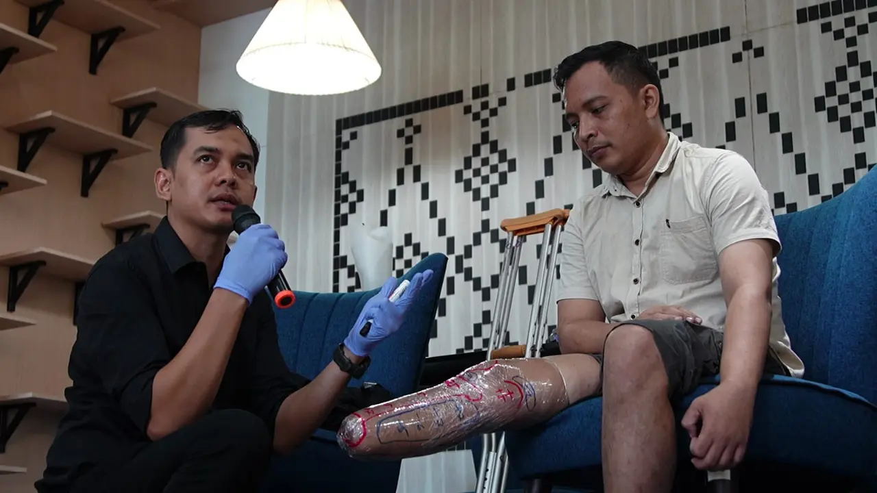 Kaki dan Tangan Prostesis Jadi Lebih Fungsional dengan Sentuhan Teknologi 3D Scan dan Printer