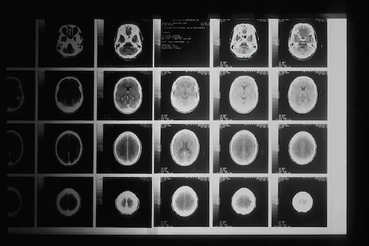 Ilustrasi X-Ray