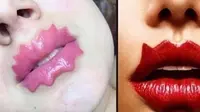 Bibir bergelombang jadi salah satu tren kecantikan aneh di Rusia saat ini (Dok.Instagram/@resumaoo/https://www.instagram.com/p/B55UhkYAYOK/Komarudin)