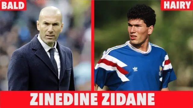 Rupa Pesepak Bola Plontos Kala Masih Memiliki Rambut