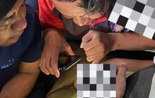 Kemaluan Bocah Kejepit Resleting, Damkar Turun Tangan