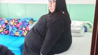 Si pemilik berat badan 240 kilogram yang menjadi wanita tergemuk di Cina jalani operasi bypass lambung, dan berharap langsing