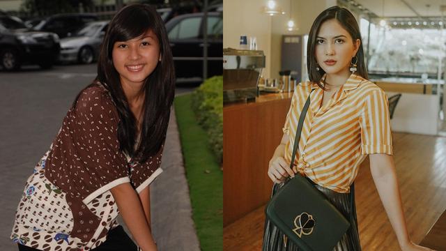 6 Potret Transformasi Jessica Mila Sudah Cantik Sedari Dulu Hot Liputan6 Com