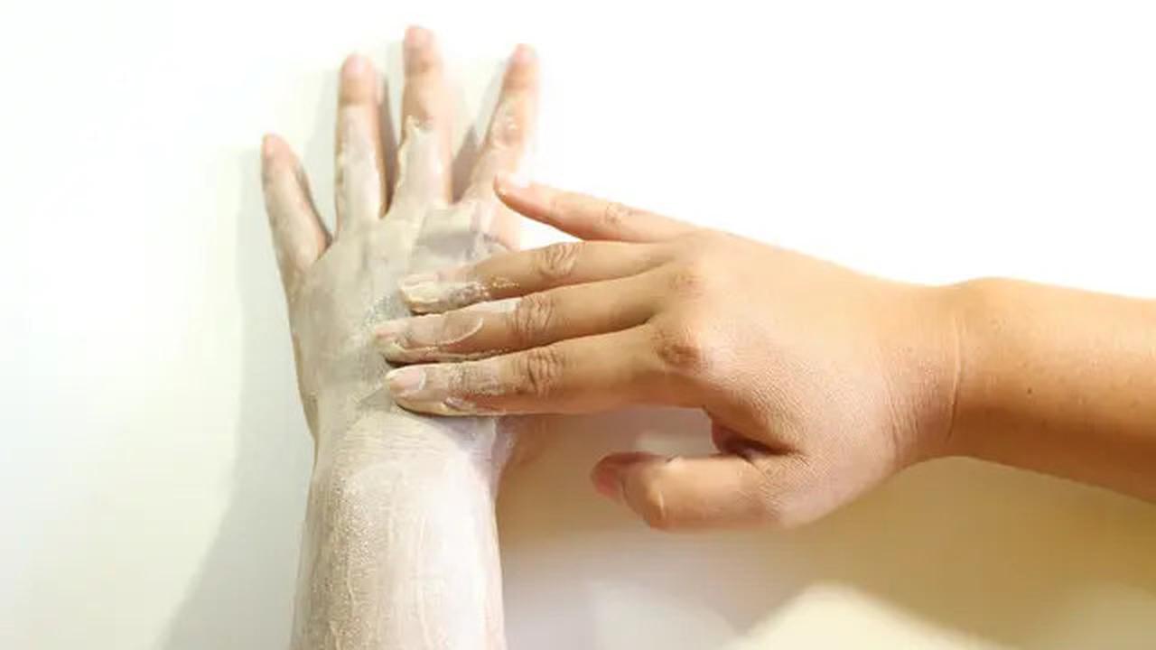 7 Cara Menghilangkan Stretch Marks, Mudah dan Efektif
