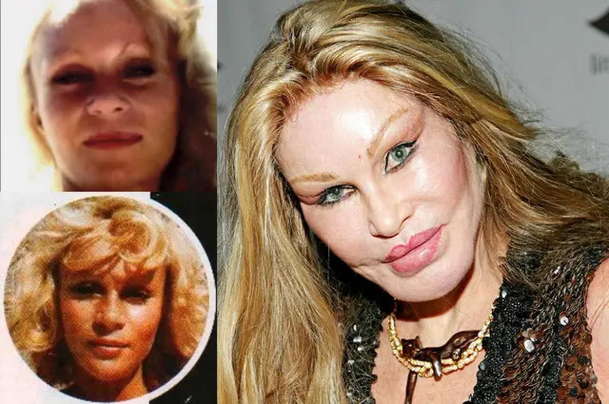 Profil Jocelyn Wildenstein 'Catwoman' yang Meninggal Dunia, Sosialita Asal Swiss Penggila Operasi Plastik