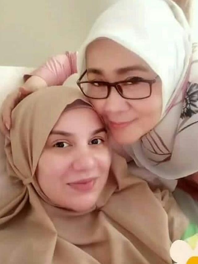 Potret Terbaru Kondisi Irish Bella (sumber: instagram/@mcholidi89)