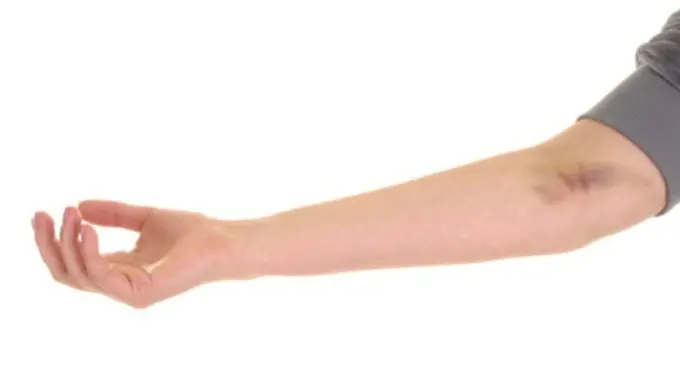 Photo: Copyright Thinkstockphotos.com